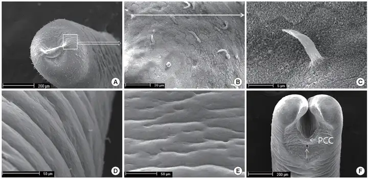 被某种生物寄生之后，他们患上了一种诡异的怪病……（病毒是一种寄生生物）