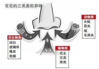 首大石萍兒童耳鼻喉多發疾病看似小毛病實際大問題