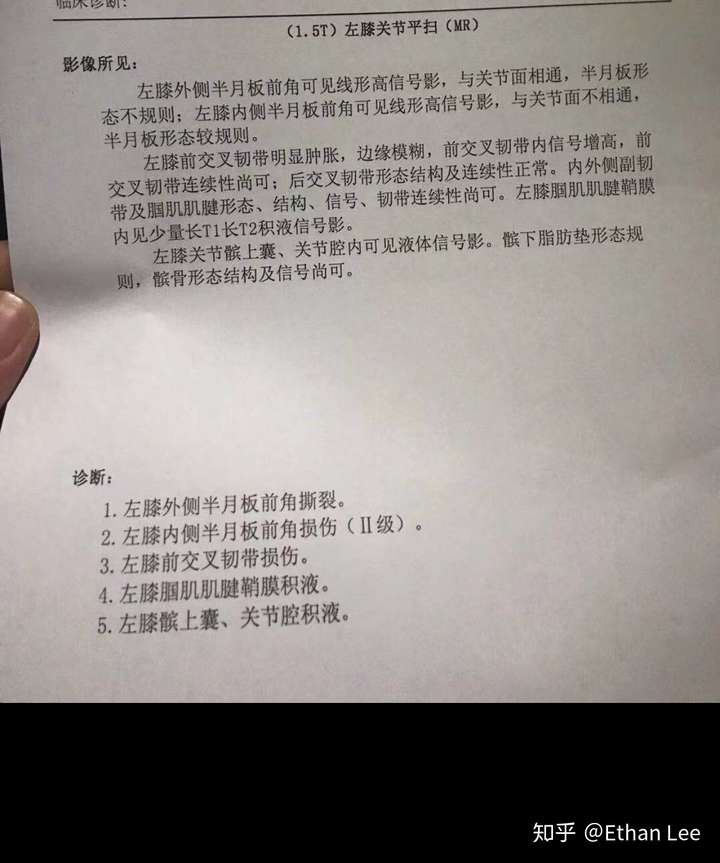 半月板撕裂能自愈吗图片