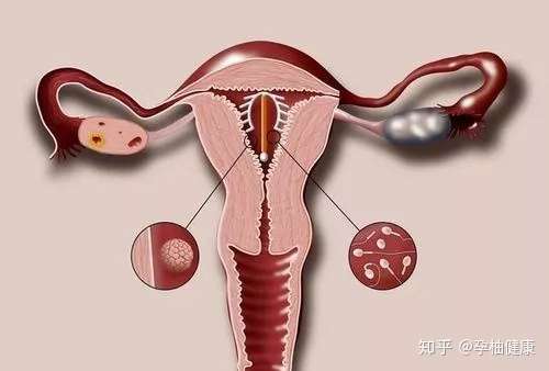 上环这件事你了解多少