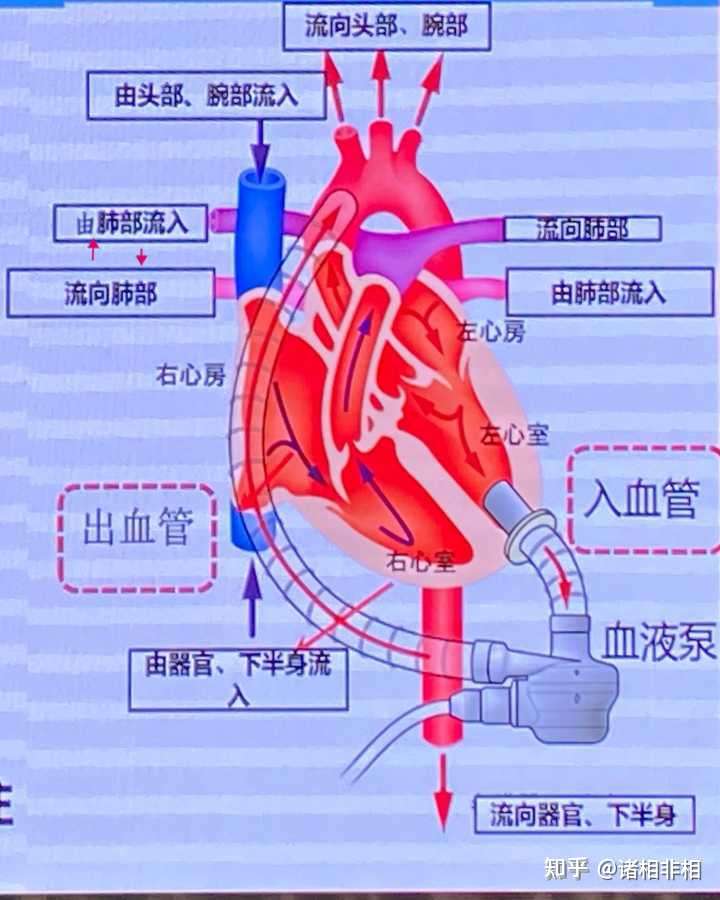 v2-e5b3d3ab021cb9c92a9cdb2075a0d95b_720w.jpg?source=1940ef5c