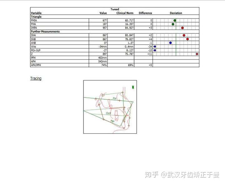 武汉牙齿矫正为什么面诊前一定要做头影测量
