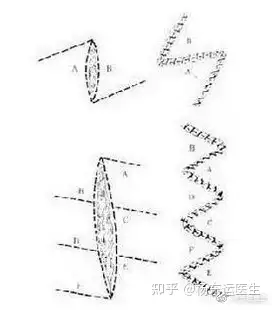 z成形术图片