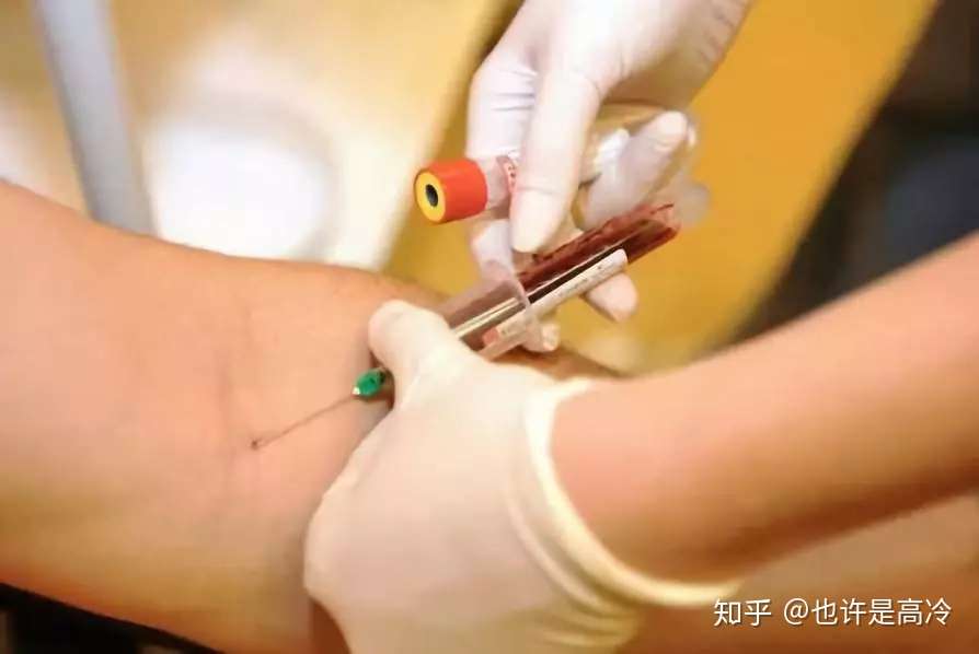 最全止血攻略 抽血后正确的按压手法 知乎 最全止血攻略 抽血后正确的按压手法 知乎
