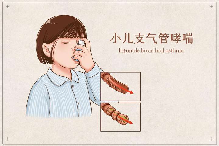 哮喘疾病患者日常生活需要注意什么用药也有5点需要小心