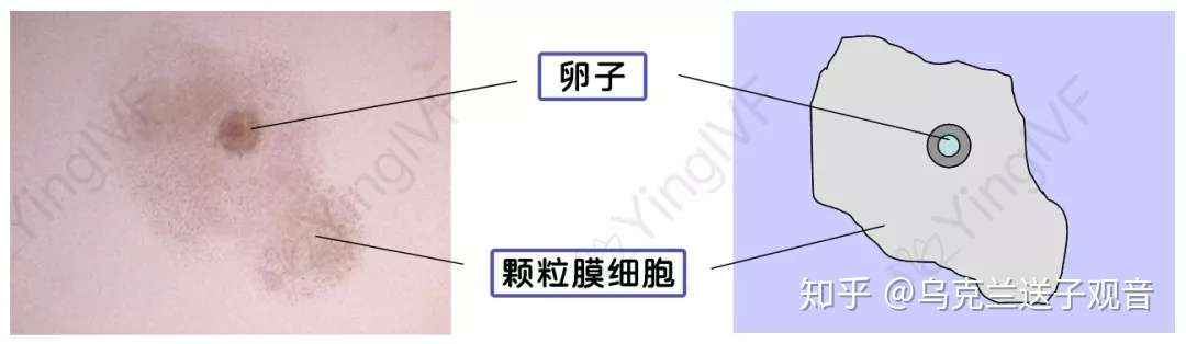 提高卵子质量在 培养师 眼中就是这3点 知乎