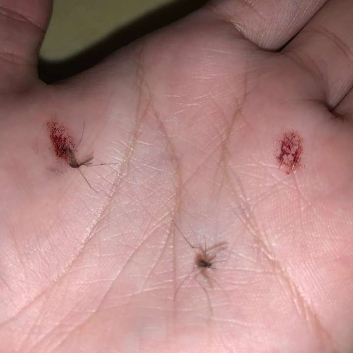 你最棒的一次是怎么把蚊子打死的?