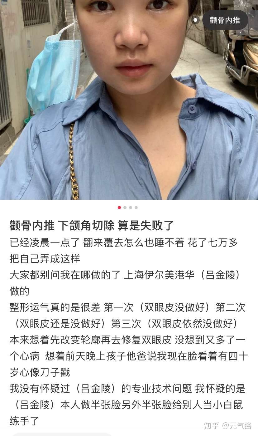 网红磨骨医生解析 大家种草的同时了解清楚网红医生的弊端 郑康在 河东镐 吉玟锡 罗奇 曹栋弼 知乎