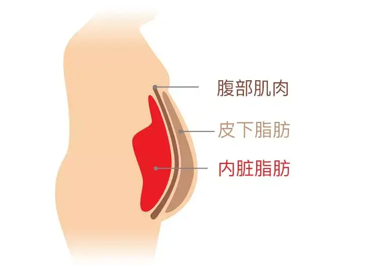 内脏脂肪怎么减 知乎