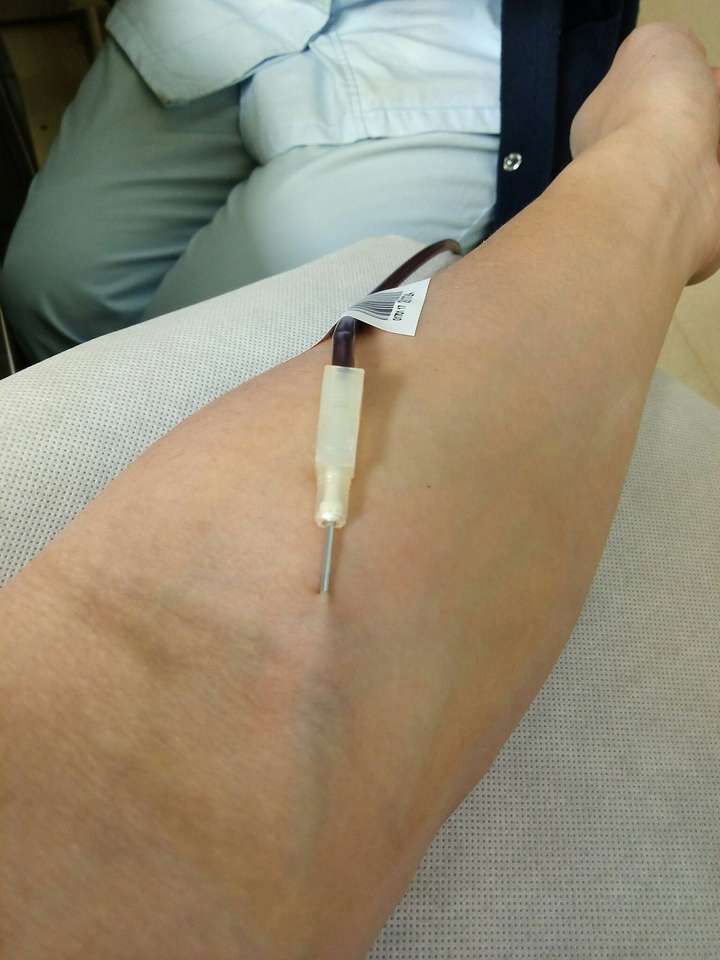 献血的时候抽血的胳膊会感觉轻微的麻木,这时候你也许会感觉头晕,肩