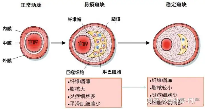 甩焰晚没监那赠访愕？萍昵瞬栅不？（安贞医院内科）北大新闻与流传学院老师，