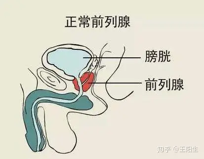 前列腺液排出图片