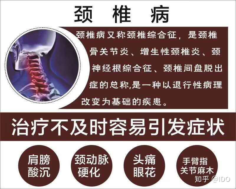 脖颈酸胀 教你超简单的颈椎操 知乎