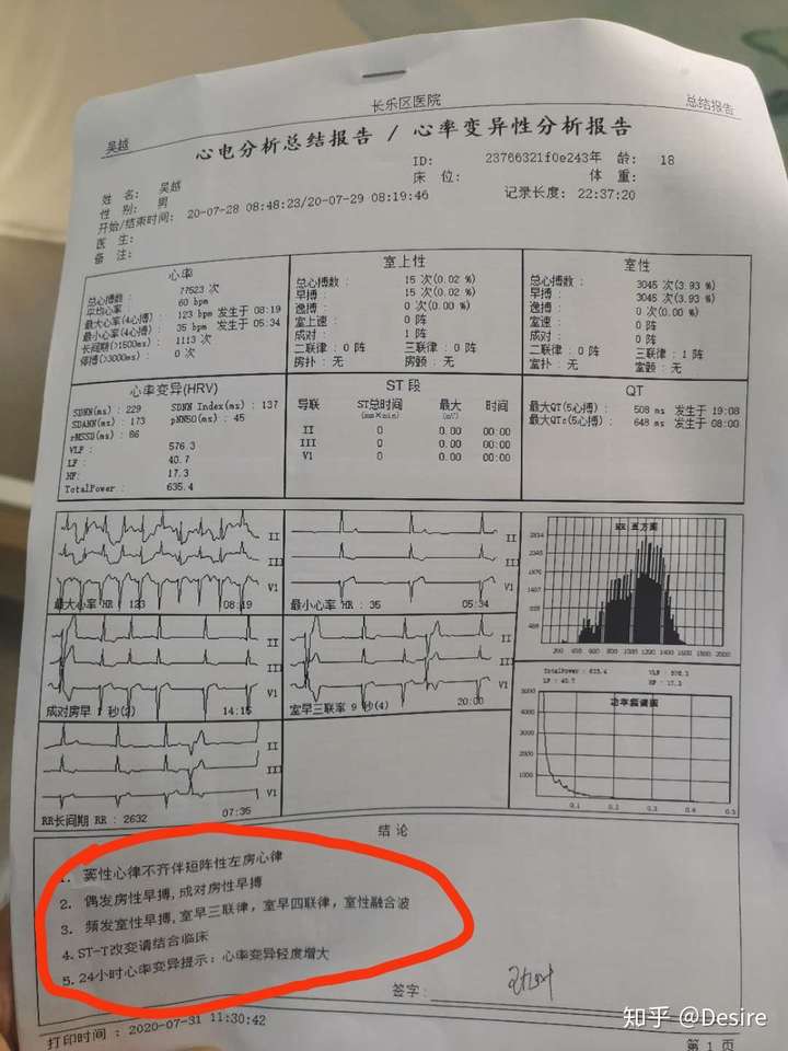今年征兵初检不正常心电图我该如何面对复检
