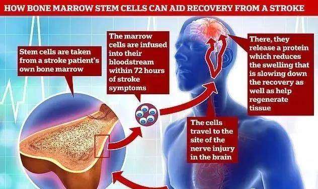 干细胞并非 万能细胞 主要治疗领域在这八大疾病领域 知乎