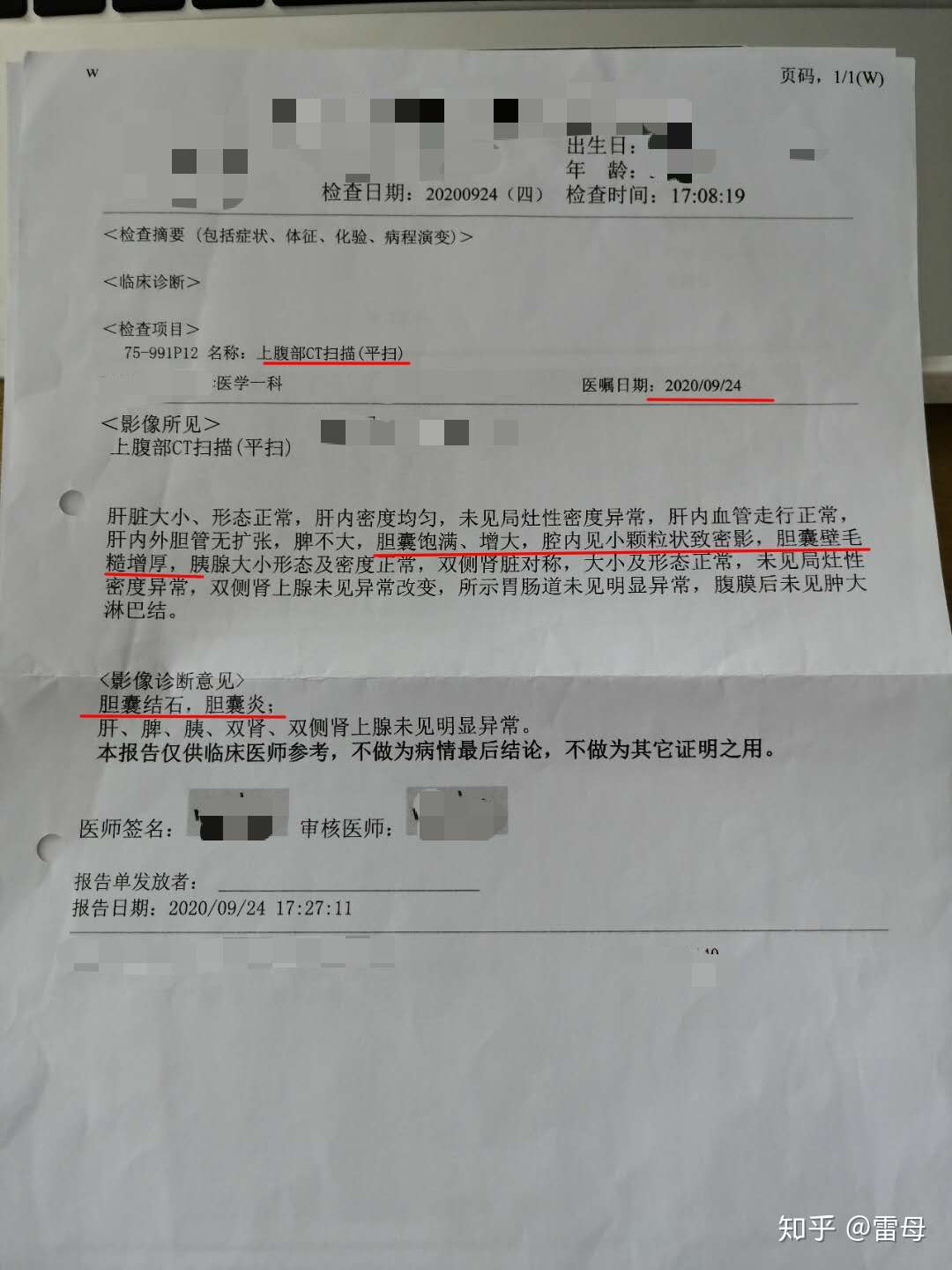 14天保守治愈胆结石 我是怎么做到的 有图有真相 知乎