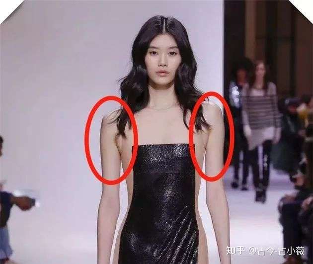 如何改善副乳？