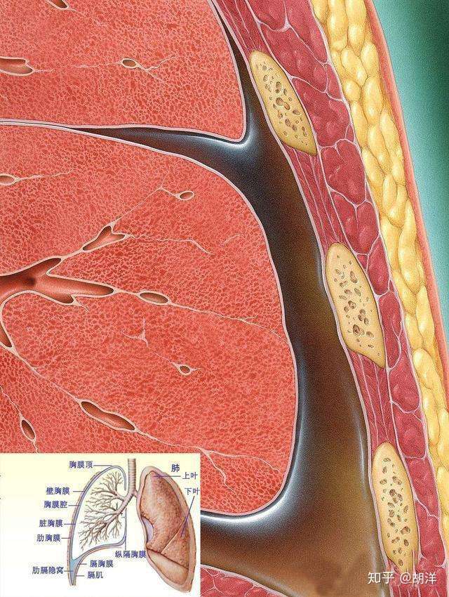 肺积水 是怎么回事 为什么肺出水要检查心 肝 肾 知乎