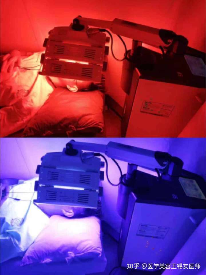 鸡肋还是用错了红蓝光比你们想的还要弱