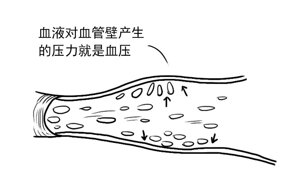 得了高血压就一定要终身服药吗