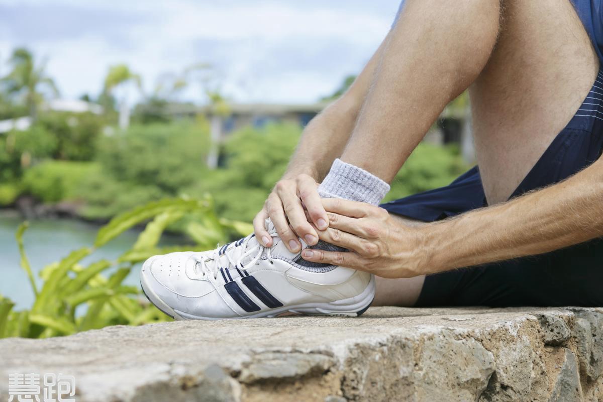 Running Athlete Feeling Pain because of Injured Leg Stock Image - Image ...
