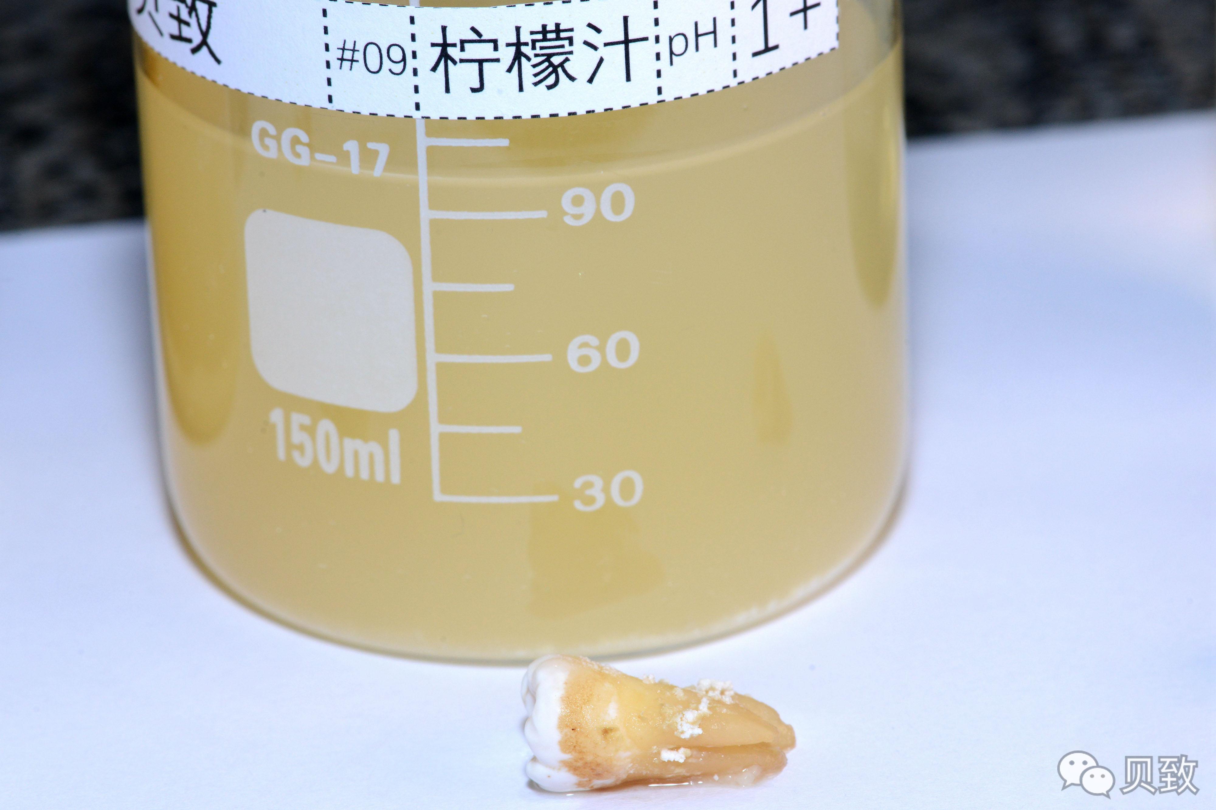 (转)谁能想到,饮料正在“谋杀”我们的牙齿 (转)谁能想到,饮料正在“谋杀”我们的牙齿