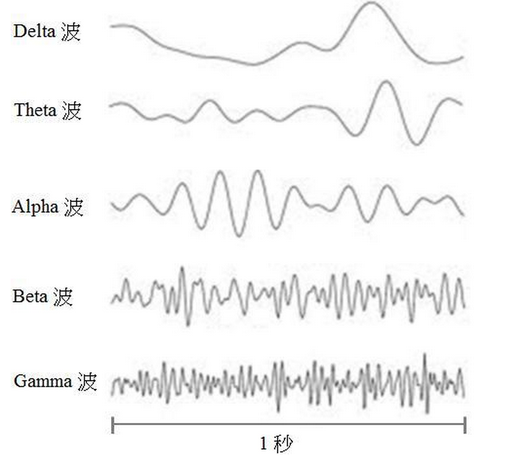 首先,脑电波反应了大脑一群神经元细胞整体的活动水平,是大脑皮层大量