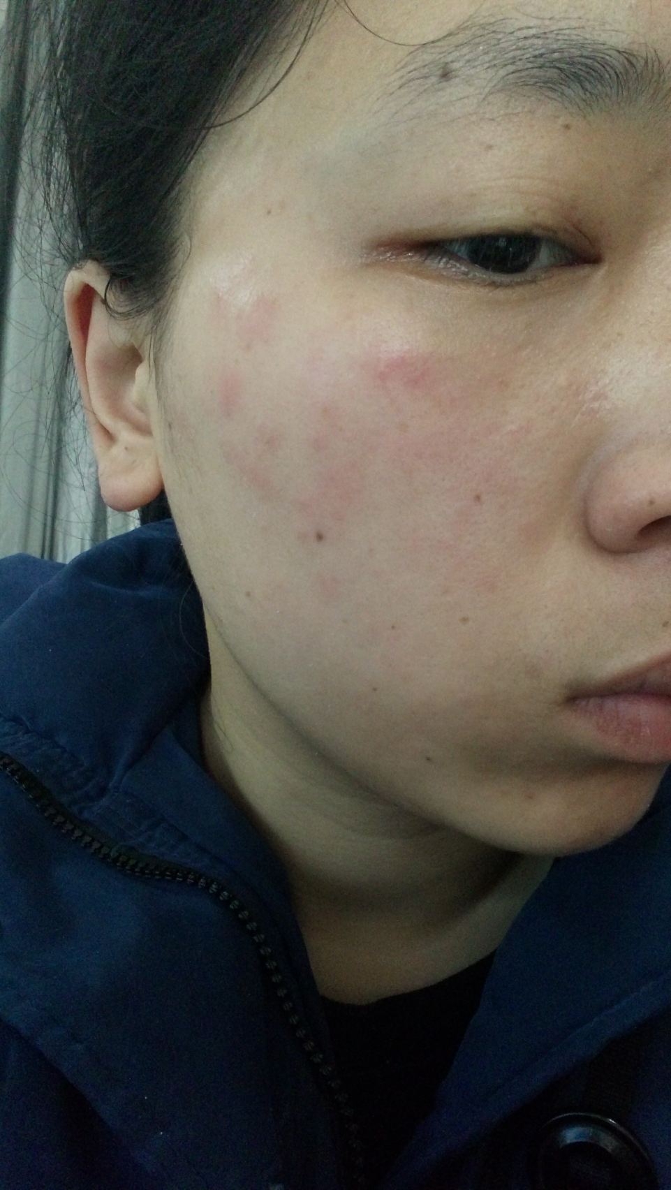 我经常这样一块一块红,不痒不痛,摸上去有点热