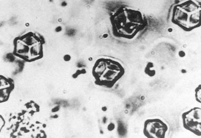 胰岛素是啥组成的 d0e8c9711e364fb066beb8d12c72c5e1_1440w.jpg?source=172ae18b