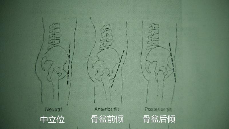 體態改善3招解決骨盆前傾氣質更出眾