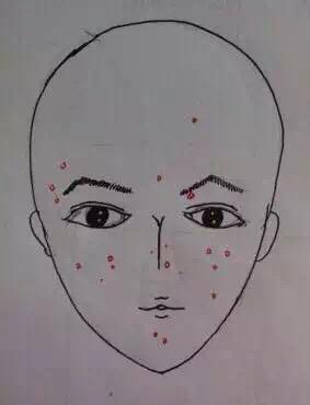 【玲玲老师小课堂】讲解痘痘会自己消失吗? -