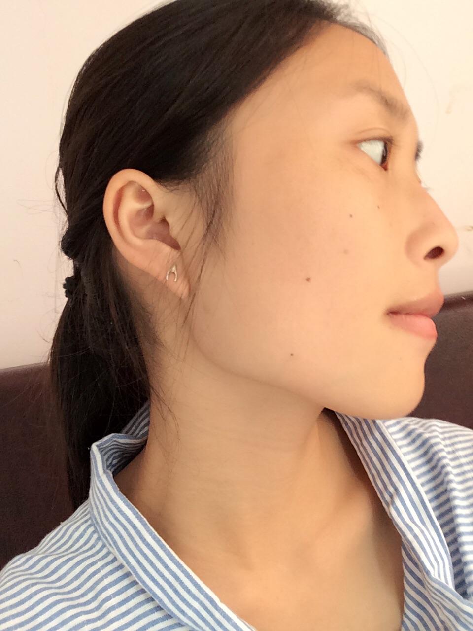 下颌骨有点宽的女生怎么办