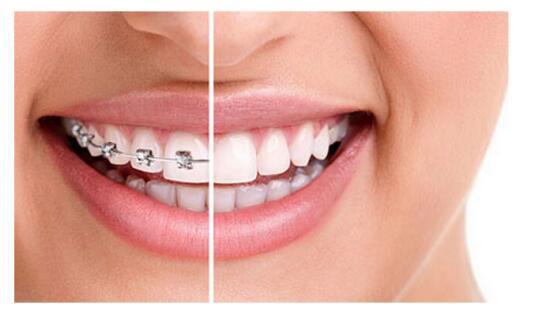 几个月出牙期 e2625b7bef47ec0aaa15a84cbe1fda69_1440w.jpg?source=172ae18b