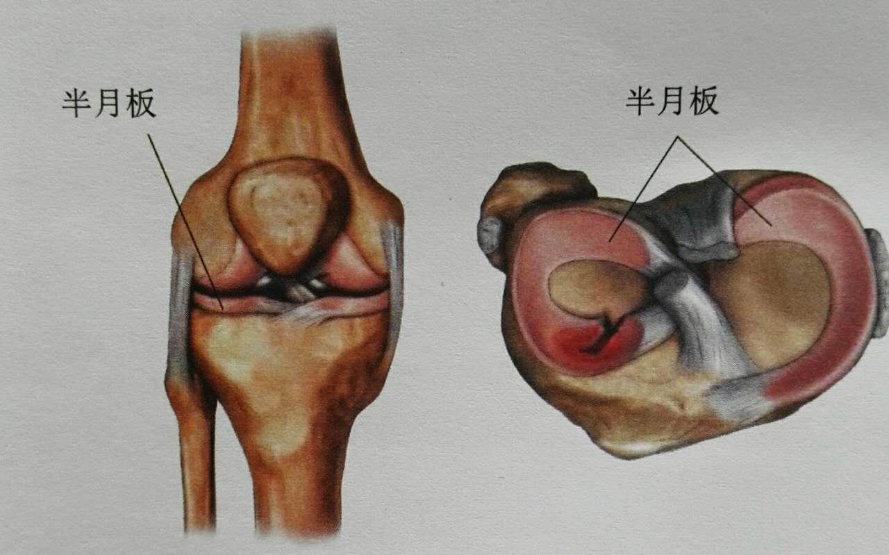 膝盖扭伤恢复期多少天？|膝关节|软组织|膝盖|扭伤|断裂|患者|-健康界