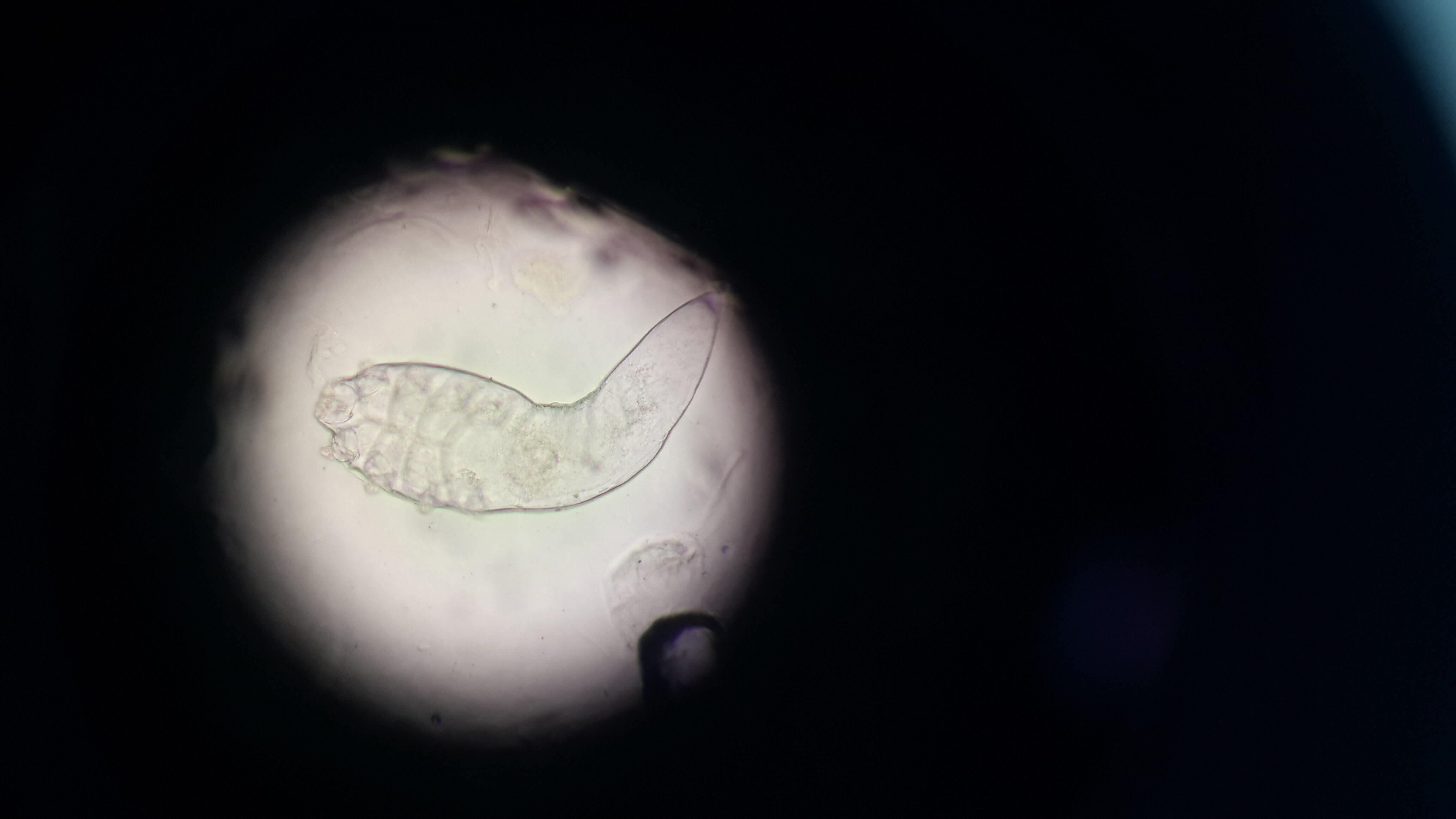 螨虫背显微镜图片