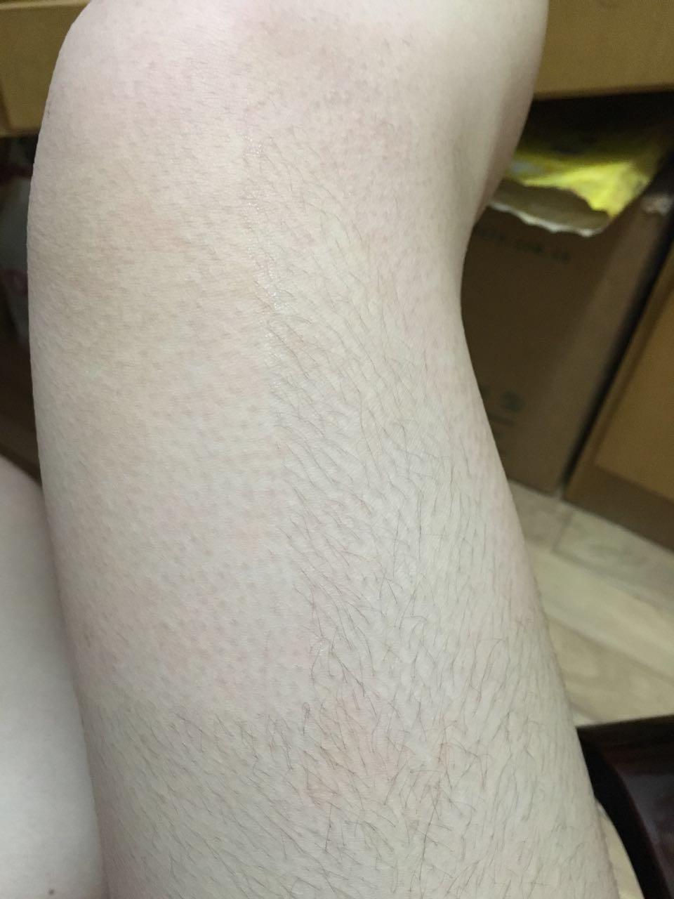 女生腿毛旺盛是怎样的人生体验