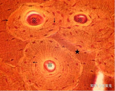图示长骨密质骨的环行骨板(a),大小不同的骨单位(b),间骨板(d)及中央