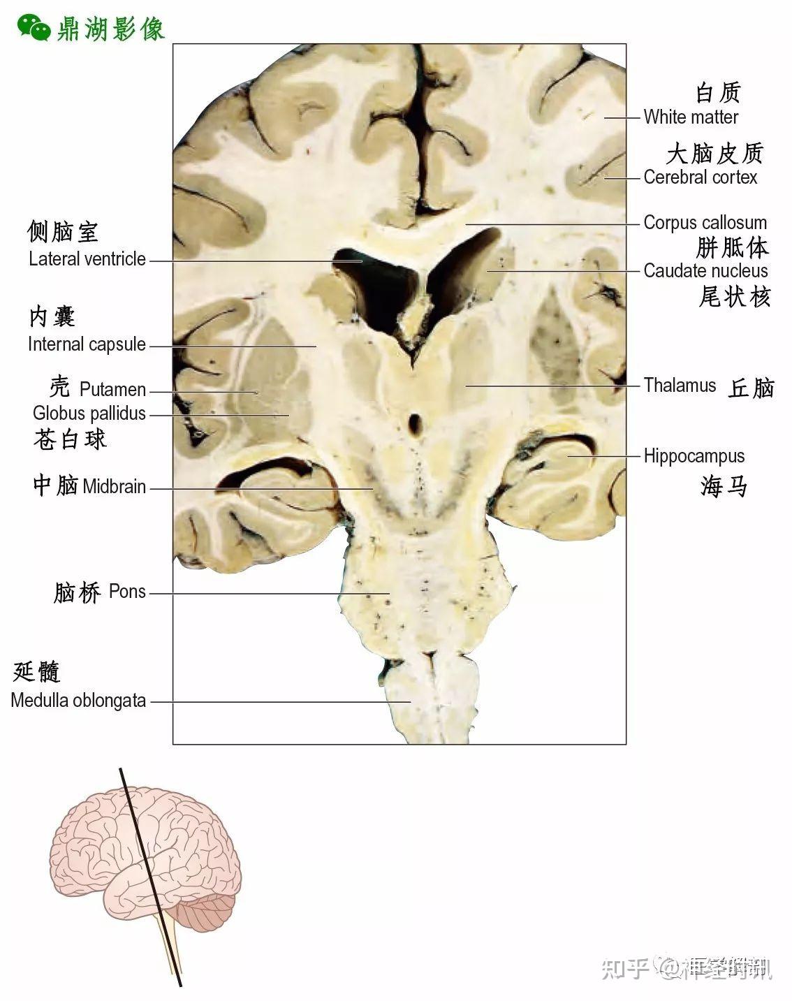 下丘脑解剖位置图片