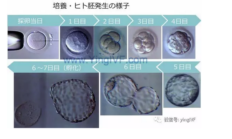 带你看看受精卵怎么培养 胚胎怎么评级 - 知乎