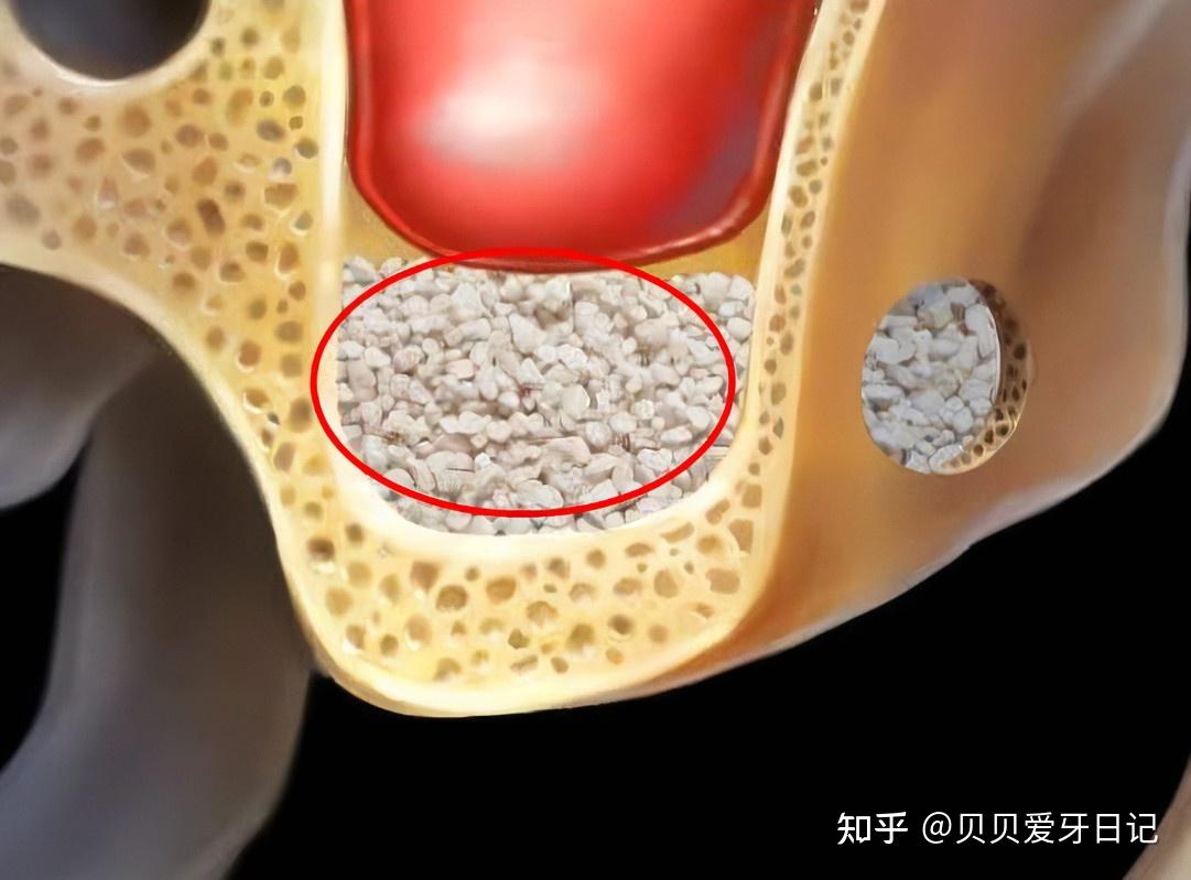 牙骨膜纤维图片