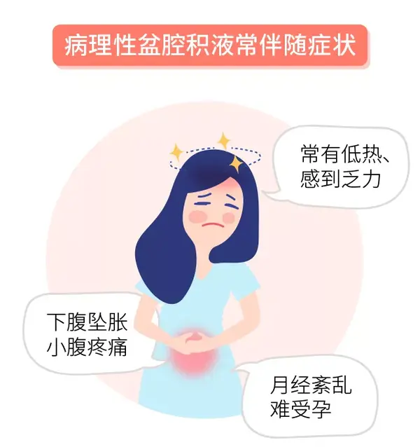 为什么我的b超报告上,总有「盆腔积液?