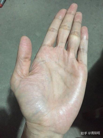 手相感情线锁链纹怎么 男人手相感情线锁链型 婚姻线锁链纹代表什么