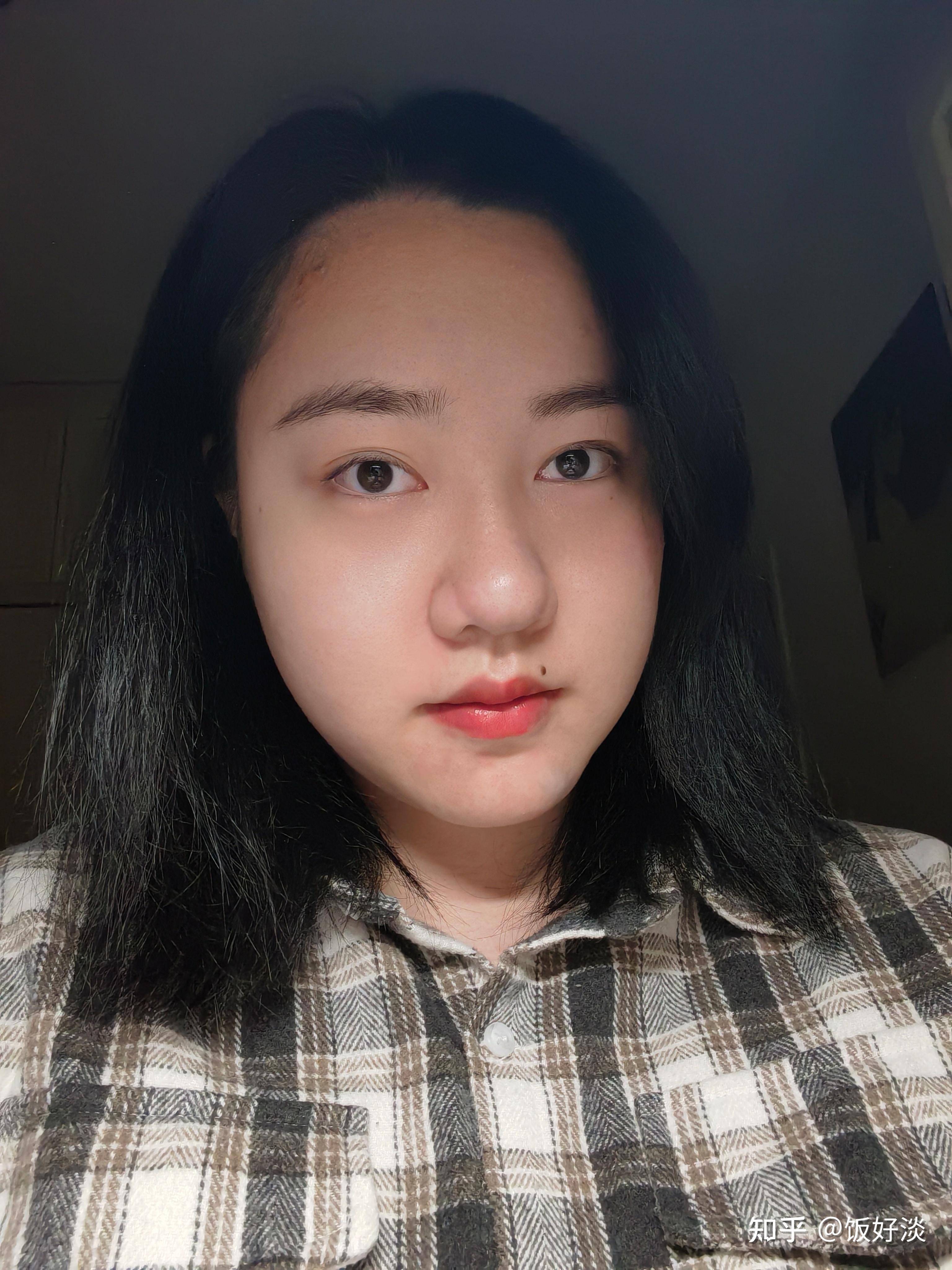 你见过蒜头鼻的美女吗? - 知乎