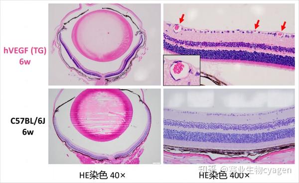 眼科新生血管疾病研究｜谁能拒绝这样表型稳定的VEGF小鼠呢？ - 知乎
