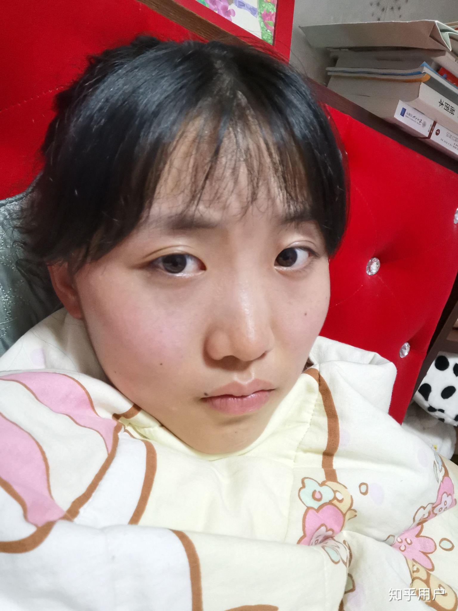 长得丑,怎样自拍才好看?