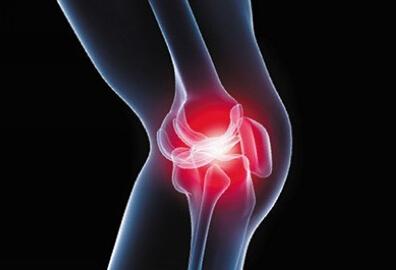 下肢关节弹响一次招飞体检可合格