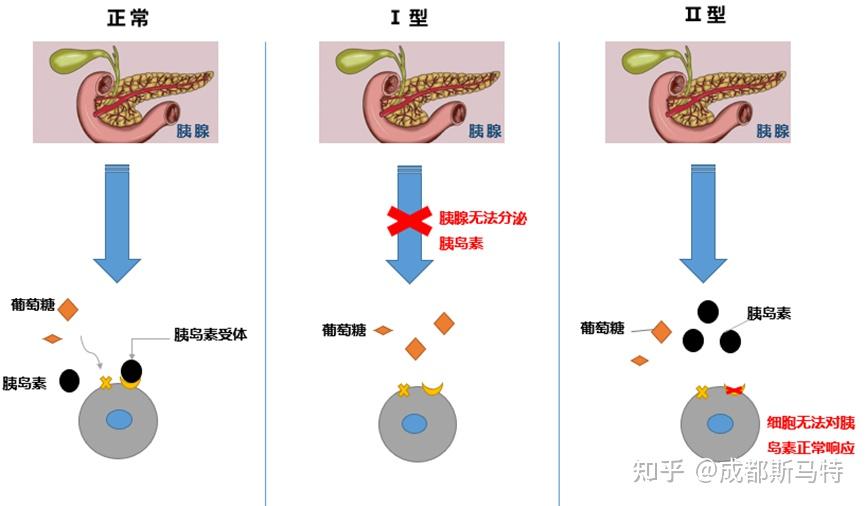 生化檢測在貓糖尿病診斷與治療管理中的臨床應用