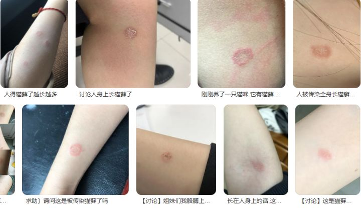 人得了猫藓初期有什么症状该如何治疗或预防