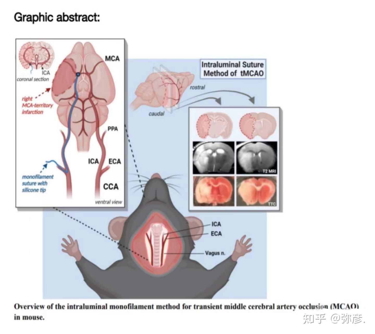 protocol 分享|脑缺血再灌注实验(mcao)附图