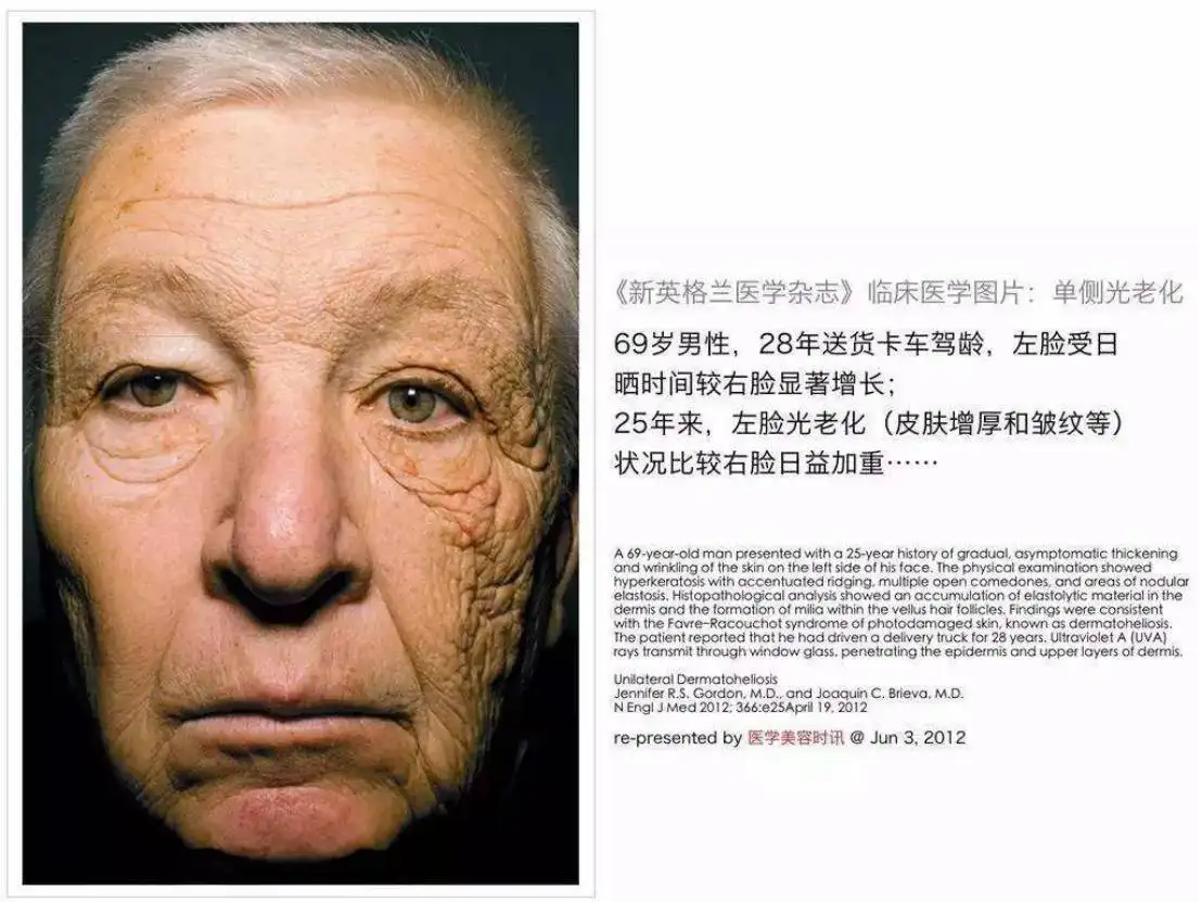 皮肤衰老的4大原因,找对方向才能轻松抗老!